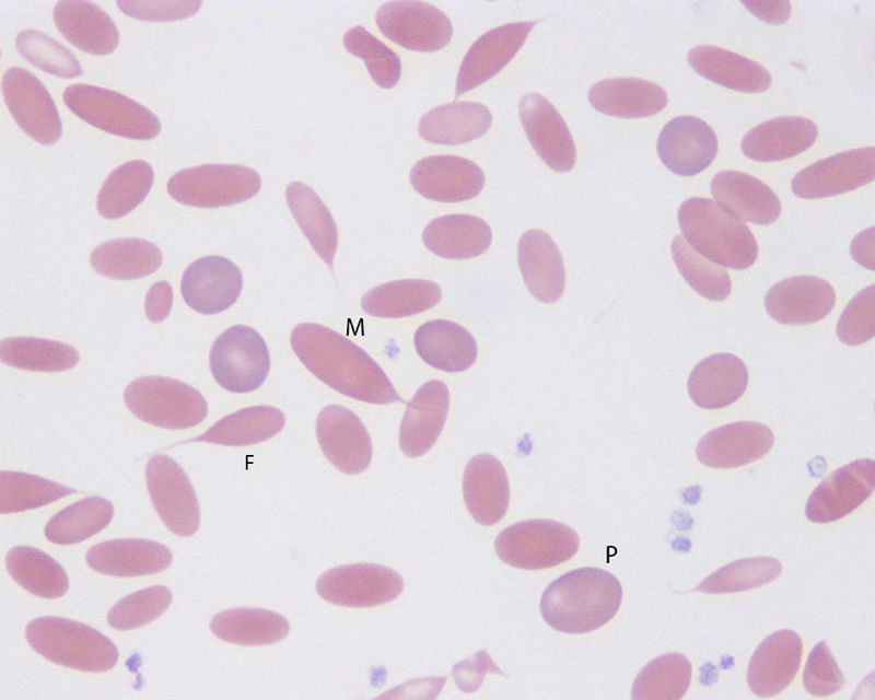 Unique Blood Cells