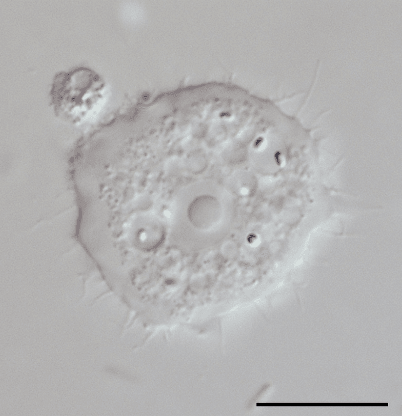 Acanthamoeba