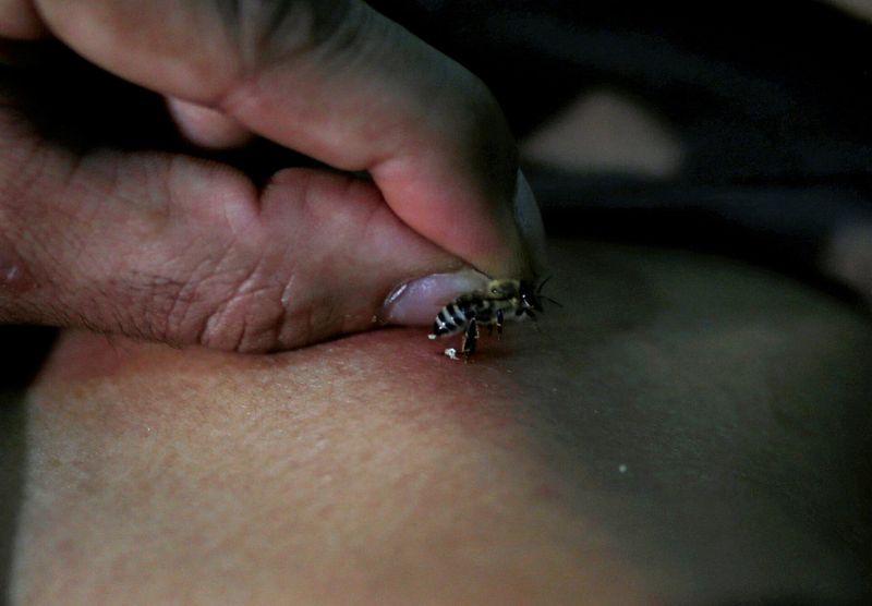 Bee Venom Therapy