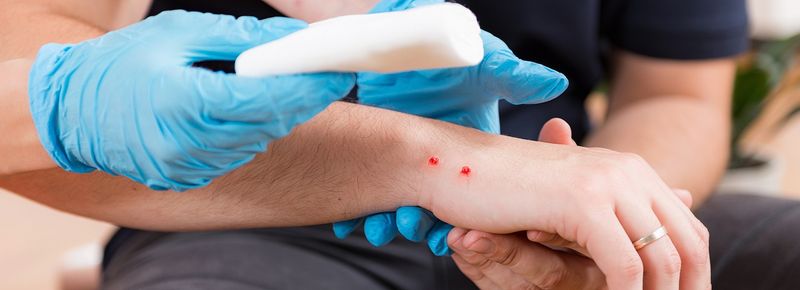 Clean the Wound