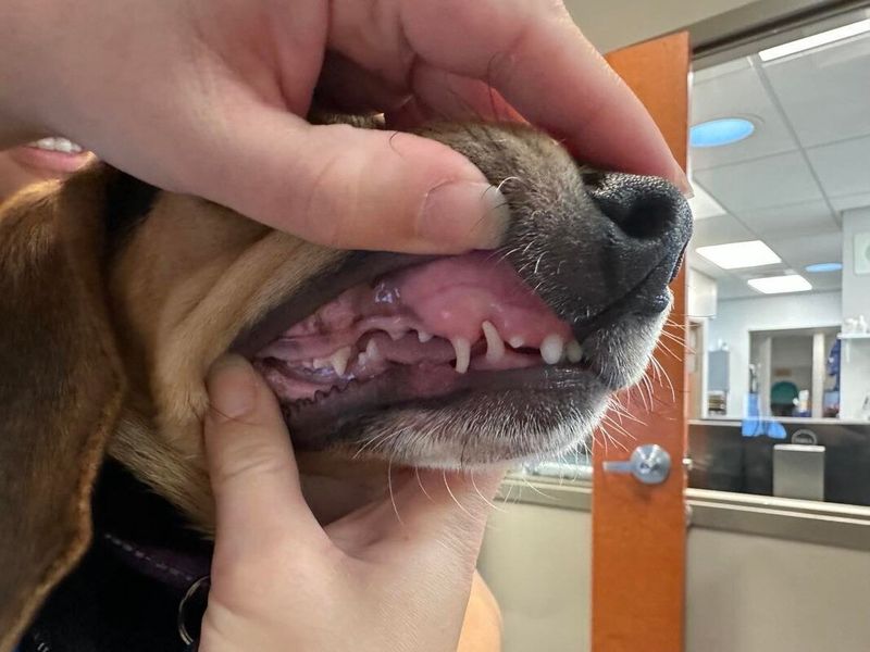Dental Issues