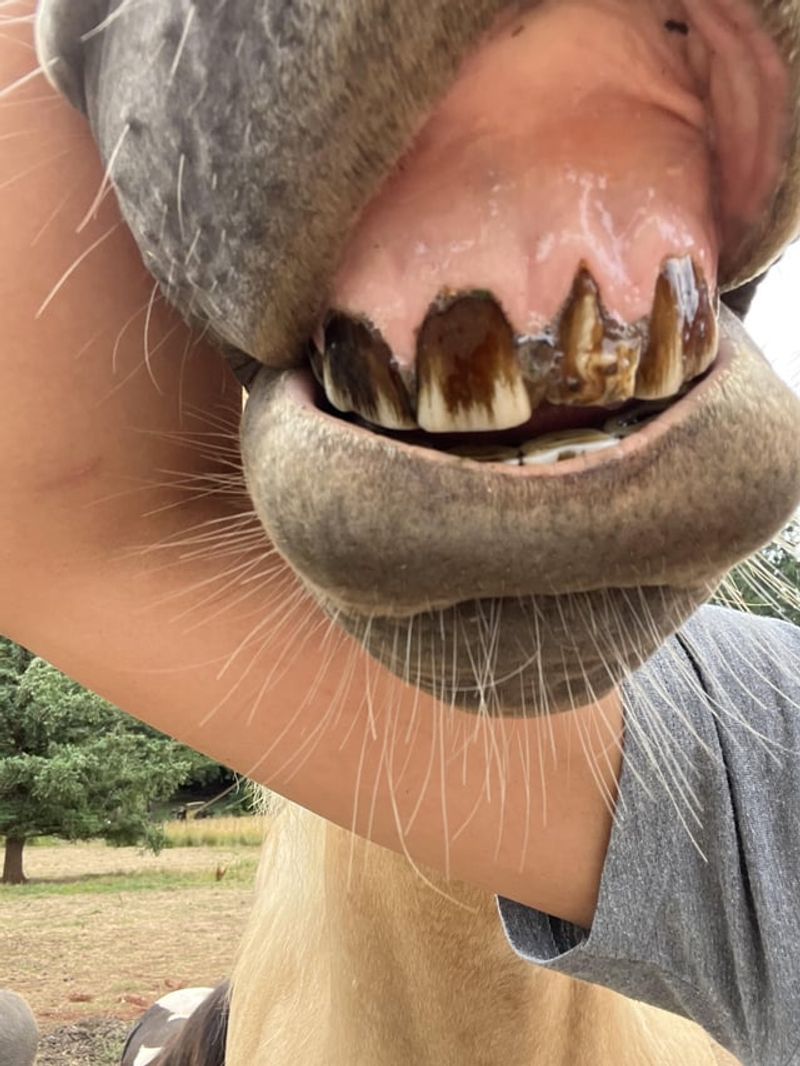 Discolored Teeth