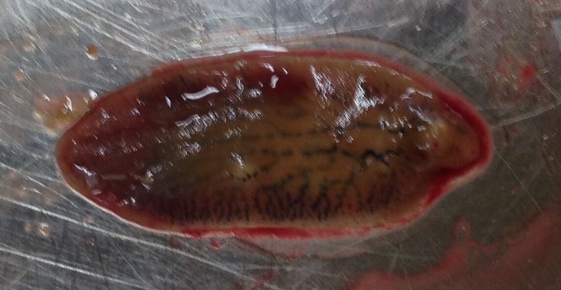 Fasciola hepatica