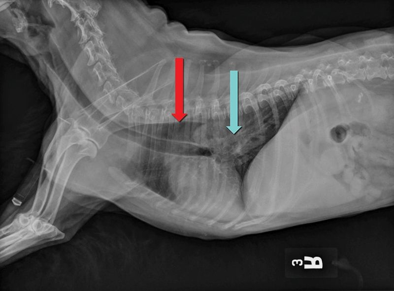 Foreign Object Ingestion