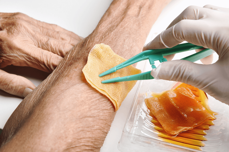 Honey for Wound Healing