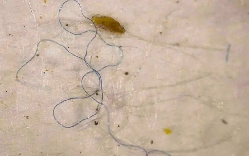 Microplastics in Insect Ecosystems
