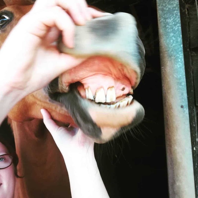 Missing Teeth