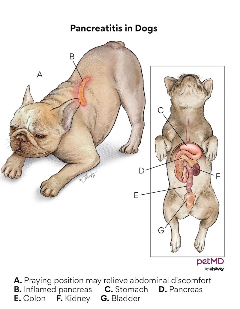Pancreatitis