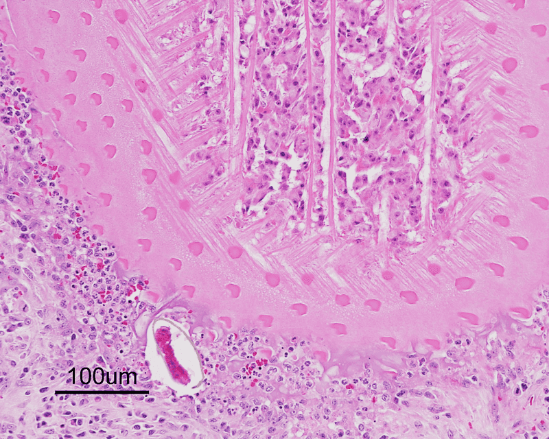 Paragonimus kellicotti