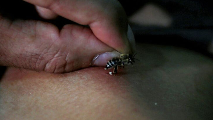 Surprising Uses for Honey Bees in Early American Medicine