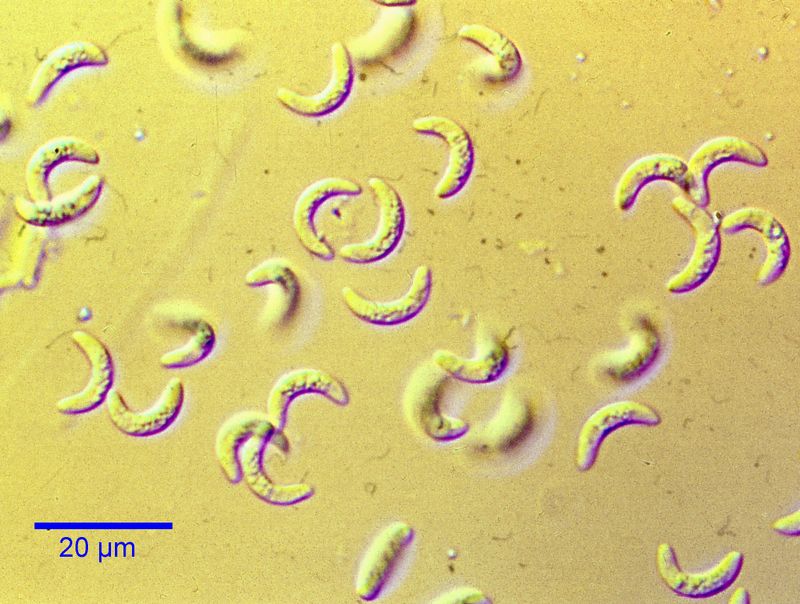 Toxoplasma gondii
