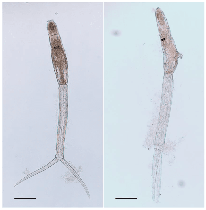 Trichobilharzia