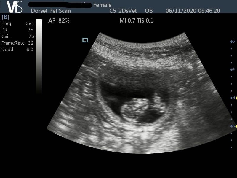 Ultrasound Discoveries